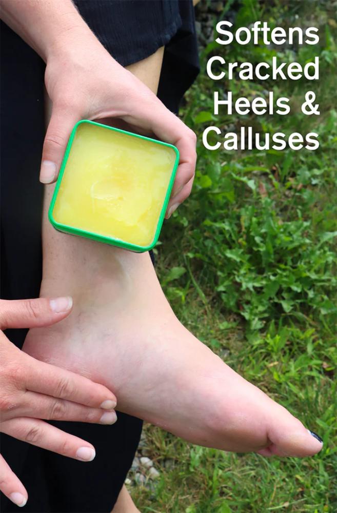 Bag Balm - Bag Balm - 8
