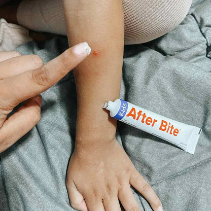 After Bite - After Bite Kids